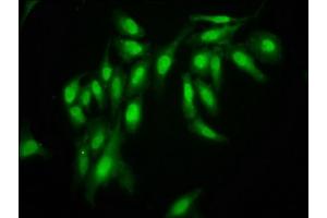 Immunofluorescence staining of Hela cells with ABIN7161246 at 1:166, counter-stained with DAPI. (AHNAK 抗体  (AA 5689-5801))
