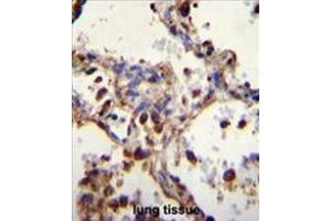 WDR52 Antibody (C-term) immunohistochemistry analysis in formalin fixed and paraffin embedded human lung tissue followed by peroxidase conjugation of the secondary antibody and DAB staining. (WDR52 抗体  (C-Term))