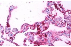 Anti-Macrophages antibody IHC staining of human lung, macrophages. (Macrophages 抗体)