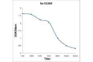 Antigen: 0. (TRAK1 抗体  (AA 171-270))