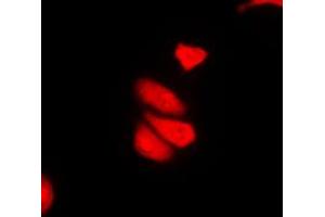 Immunofluorescent analysis of MDA5 staining in THP1 cells. (IFIH1 抗体  (C-Term))