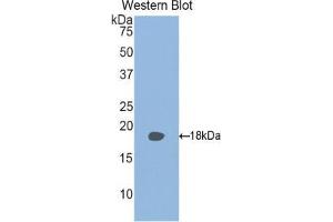 Western blot analysis of the recombinant protein. (RBP2 抗体  (AA 1-134))