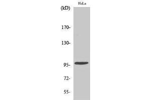 Western Blotting (WB) image for anti-Checkpoint Kinase 2 (CHEK2) (pThr68) antibody (ABIN3179414) (CHEK2 抗体  (pThr68))