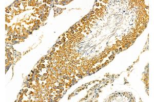 ABIN6266241 and ABIN6277393 at 1/100 staining Rat testis tissue by IHC-P. (Kallikrein 2 抗体  (Internal Region))