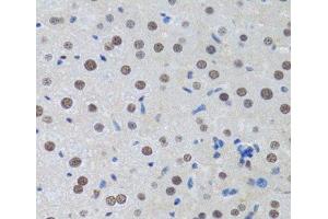 Immunohistochemistry of paraffin-embedded Rat liver using MTA3 Polyclonal Antibody at dilution of 1:100 (40x lens). (MTA3 抗体)