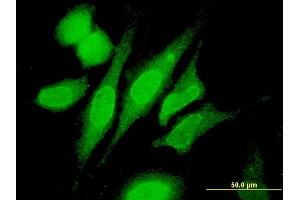 Immunofluorescence of monoclonal antibody to RNF180 on HeLa cell. (RNF180 抗体  (AA 1-100))