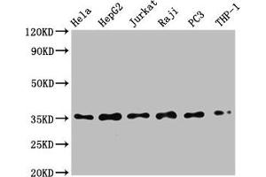 Western Blot Positive WB detected in: Hela whole cell lysate, HepG2 whole cell lysate, Jurkat whole cell lysate, Raji whole cell lysate, PC3 whole cell lysate, THP-1 whole cell lysate All lanes: NFKBIA antibody at 0. (Recombinant NFKBIA 抗体)