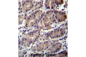 Immunohistochemistry (Paraffin-embedded Sections) (IHC (p)) image for anti-Ring Finger Protein 5, E3 Ubiquitin Protein Ligase (RNF5) (AA 64-94), (Middle Region) antibody (ABIN954576)
