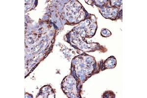 Immunohistochemistry (IHC) image for anti-Peroxiredoxin 4 (PRDX4) antibody (ABIN7269238)