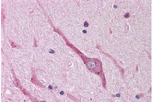 Human Brain, Cerebellum (formalin-fixed, paraffin-embedded) stained with SNAI2 antibody ABIN214479 at 2. (SLUG 抗体  (Internal Region))