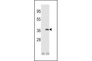 Western blot analysis of IL1A (arrow) using rabbit polyclonal IL1A-pS87 (ABIN390844 and ABIN2841070). (IL1A 抗体  (AA 65-94))
