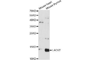 Western blot analysis of extracts of various cell lines, using LACRT antibody (ABIN6293118) at 1:3000 dilution. (Lacritin 抗体)