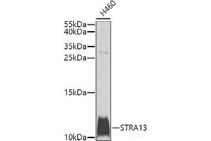Western blot analysis of extracts of H460 cells using STRA13 Polyclonal Antibody at dilution of 1:1000.