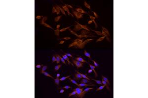 Immunofluorescence analysis of PC-12 cells using PI3 Kinase p85 alpha Rabbit pAb (ABIN6130616, ABIN6145641, ABIN6145644 and ABIN6215094) at dilution of 1:100 (40x lens). (PIK3R1 抗体)