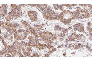 Immunohistochemistry (IHC) image for anti-Olfactory Receptor, Family 2, Subfamily V, Member 2 (OR2V2) (Internal Region) antibody (ABIN6259520)