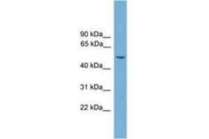 Image no. 1 for anti-WD Repeat, Sterile alpha Motif and U-Box Domain Containing 1 (WDSUB1) (AA 359-408) antibody (ABIN6745596)
