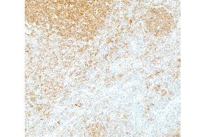 Immunohistochemistry (IHC) image for anti-REL proto-oncogene (c-Rel) (C-Term) antibody (ABIN7795771)
