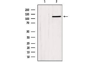 Western blot analysis of extracts from Hela, using SLC24A1 Antibody. (SLC24A1 抗体  (N-Term))