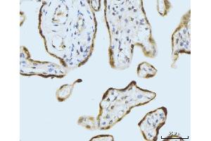 IHC analysis of SBNO1 using anti-SBNO1 antibody (ABIN7601710). (SBNO1 抗体  (AA 43-1303))