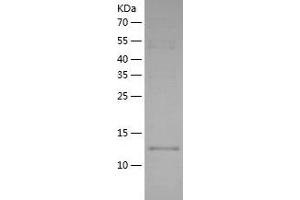 Western Blotting (WB) image for Trafficking Protein Particle Complex 2 (TRAPPC2) (AA 1-140) protein (His-IF2DI Tag) (ABIN7125426)
