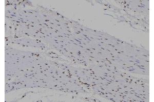 ABIN6277272 at 1/100 staining Human gastric tissue by IHC-P. (Mre11 抗体  (C-Term))