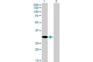 Western Blot analysis of SCP2 expression in transfected 293T cell line by SCP2 MaxPab polyclonal antibody. (SCP2 抗体  (AA 1-322))