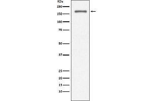 Western blot analysis of CD11a expression in Jurkat cell lysate.