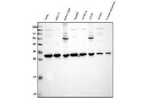 Western blot analysis of VAPB using anti-VAPB antibody (ABIN5693292). (VAPB 抗体  (AA 2-55))