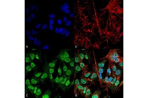 Immunocytochemistry/Immunofluorescence analysis using Mouse Anti-Alpha Synuclein Monoclonal Antibody, Clone 3F8 (ABIN5564101).
