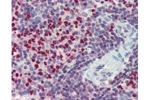 FCHO1 antibody was used for immunohistochemistry at a concentration of 4-8 ug/ml.