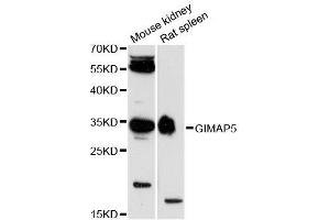 Western blot analysis of extracts of various cell lines, using GIMAP5 antibody (ABIN5996705) at 1:3000 dilution. (GIMAP5 抗体)