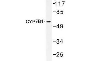 Image no. 1 for anti-Cytochrome P450, Family 7, Subfamily B, Polypeptide 1 (CYP7B1) antibody (ABIN317809) (CYP7B1 抗体)