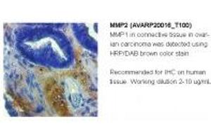 Image no. 1 for anti-Matrix Metalloproteinase 2 (MMP2) (C-Term) antibody (ABIN184263)
