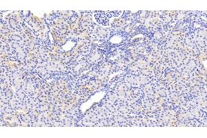 Immunohistochemistry (IHC) image for anti-serpin Peptidase Inhibitor, Clade B (Ovalbumin), Member 3 (SERPINB3) (AA 1-210) antibody (ABIN7442831)