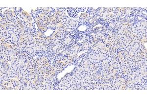 Detection of SERPINB3 in Human Kidney Tissue using Polyclonal Antibody to Serpin B3 (SERPINB3) (SERPINB3 抗体  (AA 1-210))
