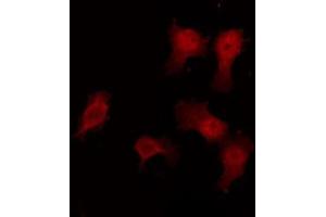 ABIN6272458 staining HuvEc by IF/ICC. (Vomeronasal 1 Receptor 3 (VMN1R3) 抗体)