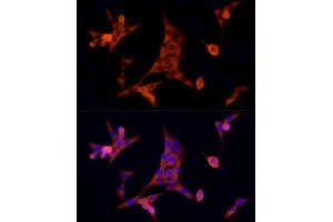 Immunofluorescence analysis of NIH/3T3 cells using MTAP Rabbit mAb (ABIN7268498) at dilution of 1:100 (40x lens). (MTAP 抗体)