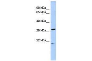 Image no. 1 for anti-Chromosome 14 Open Reading Frame 80 (C14ORF80) (AA 195-228) antibody (ABIN6741367) (C14ORF80 抗体  (AA 195-228))