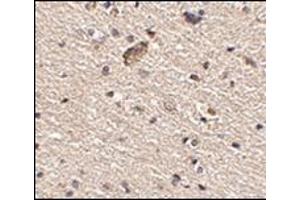 Immunohistochemistry of Spred1 in human brain tissue with this product at 2. (SPRED1 抗体  (Center))