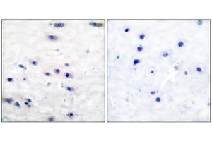 Immunohistochemical analysis of paraffin-embedded human brain tissue using Tyrosine Hydroxylase (epitope around residue 19) antibody (ABIN5976157). (Tyrosine Hydroxylase 抗体  (Ser19))
