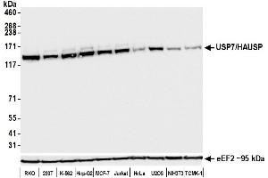 Western Blotting (WB) image for anti-Ubiquitin Specific Peptidase 7 (Herpes Virus-Associated) (USP7) (AA 1-50) antibody (ABIN7453991) (Recombinant USP7 抗体  (AA 1-50))