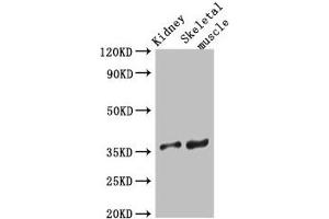Western Blot Positive WB detected in: Mouse kidney tissue, Mouse skeletal muscle tissue All lanes: SLC25A32 antibody at 3 μg/mL Secondary Goat polyclonal to rabbit IgG at 1/50000 dilution Predicted band size: 36 kDa Observed band size: 36 kDa (SLC25A32 抗体  (AA 44-88))