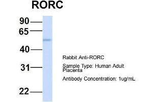 Host:  Rabbit  Target Name:  RORC  Sample Type:  Human Adult Placenta  Antibody Dilution:  1. (RORC 抗体  (Middle Region))