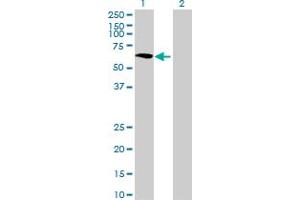 Western Blot analysis of GALNTL1 expression in transfected 293T cell line ( H00057452-T01 ) by GALNTL1 MaxPab polyclonal antibody. (GALNTL1 抗体  (AA 1-558))