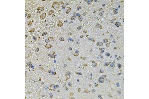 Immunohistochemistry of paraffin-embedded mouse brain using CREBBP antibody (ABIN5974440) at dilution of 1/100 (40x lens). (CBP 抗体)