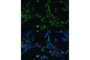 Immunofluorescence analysis of NIH-3T3 cells using eEF1G Polyclonal Antibody (ABIN6133514, ABIN6139951, ABIN6139952 and ABIN6223877) at dilution of 1:100 (40x lens). (EEF1G 抗体  (AA 168-437))