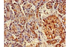 Immunohistochemistry of paraffin-embedded human pancreatic tissue using ABIN7144793 at dilution of 1:100 (Ataxin 3 抗体  (AA 1-288))