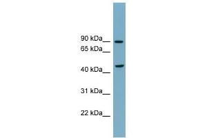 SMPD2 antibody used at 1 ug/ml to detect target protein. (SMPD2 抗体)