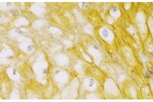 Immunohistochemistry (Paraffin-embedded Sections) (IHC (p)) image for anti-Actinin, alpha 1 (ACTN1) antibody (ABIN7255688)