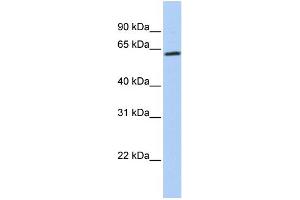 WB Suggested Anti-ZNF397 Antibody Titration:  0. (ZNF397 抗体  (Middle Region))